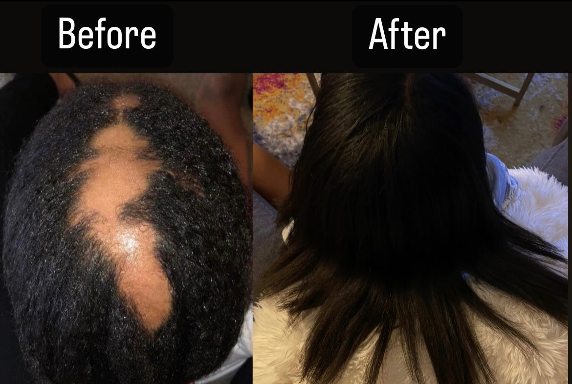 The Mamas' Halo Hair Growth Oil mamashalohairoil